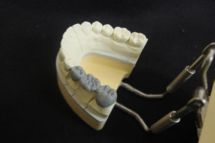 歯冠修復技工学